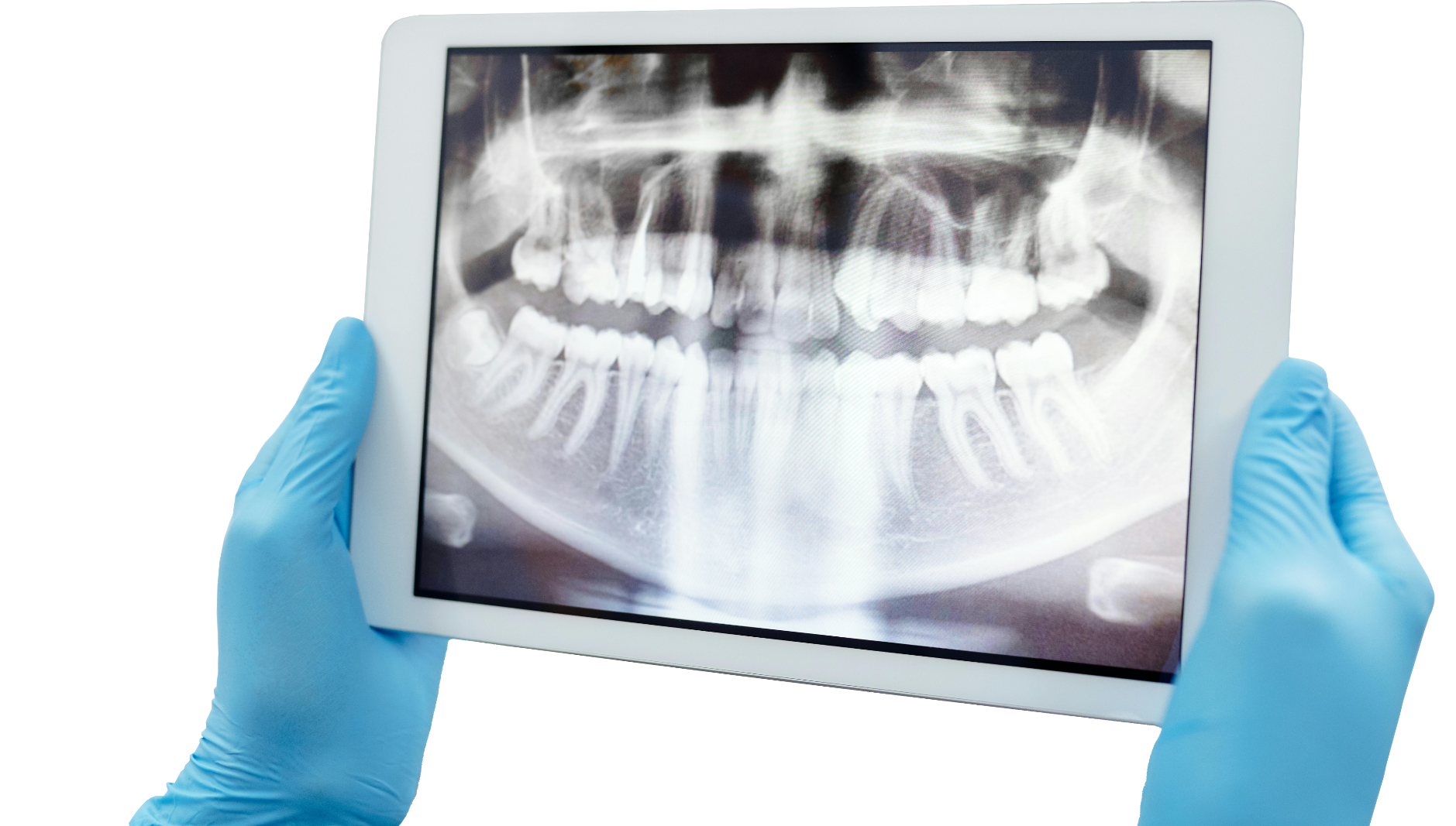 X-Ray on iPad